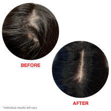 Load image into Gallery viewer, HAIRtamin scalp serum before after