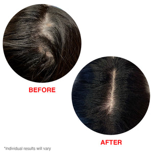 HAIRtamin scalp serum before after